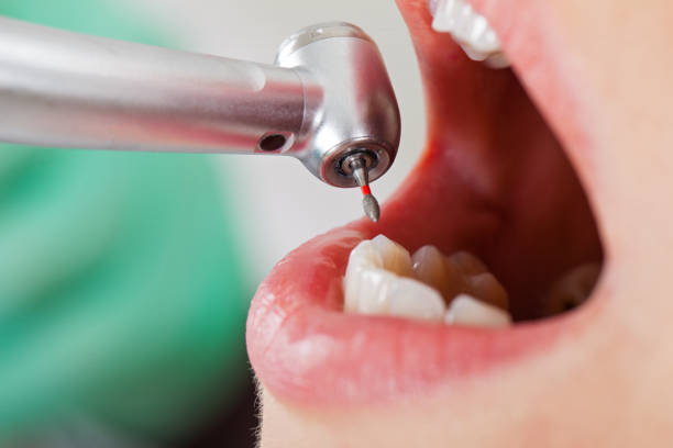 Best Emergency Treatment for Jaw Pain or Injury in Crestview, FL